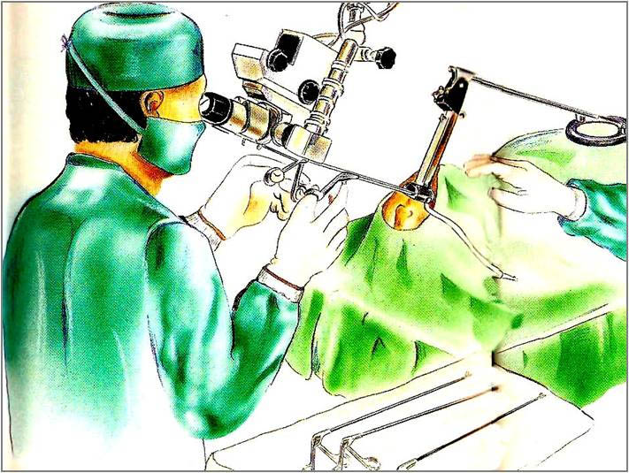 T&eacute;cnica de la Microcirug&iacute;a endolar&iacute;ngea