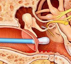 Maniobra totalmente desaconsejable